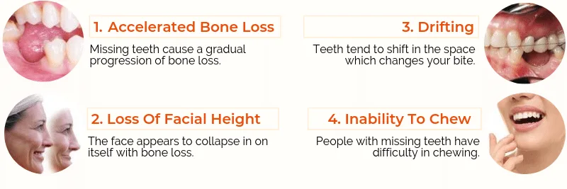 Dental Implant Emailer 2